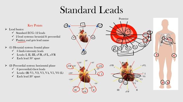 6.Standard Leads смотреть онлайн