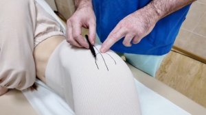 Доступы при эндопротезировании тазобедренного суста?