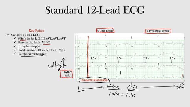 10.Standard 12-Lead ECG смотреть онлайн