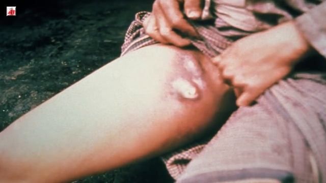 САМЫЕ СТРАШНЫЕ БОЛЕЗНИ 18+ смотреть онлайн