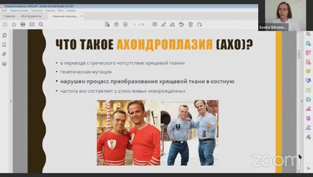 Светлана Стронова Ношение малыша с ахондроплазией (АХО). Реальный кейс