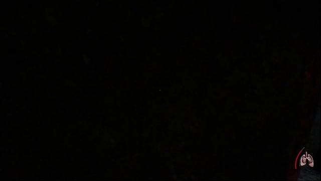 Agony | Агония - 4 серия. "Жгучий лёд". 18+ смотреть онлайн