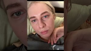 Нижняя блефаропластика. Честный отзыв спустя 2 месяца.