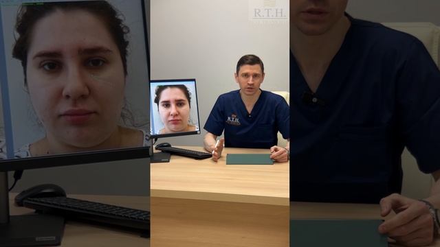 Коррекция малярных мешков с помощью липофилинга☀️ смотреть онлайн