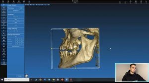 Обучение хирургическим шаблонам в программе RealGuide. Начало работы, настройка файлов.