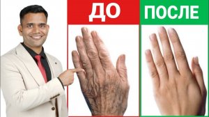 1 СРЕДСТВО ОТ МОРЩИН НА РУКАХ И ПИГМЕНТНЫХ ПЯТЕН.