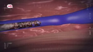 Я стесняюсь своего тела Россия Сезон 2 Выпуск 12 S02E12