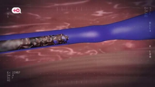 Я стесняюсь своего тела Россия Сезон 2 Выпуск 12 S02E12