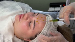 Пилинг БиоРеПил BioRePeelCl3 . Раскрываем секреты с космето?