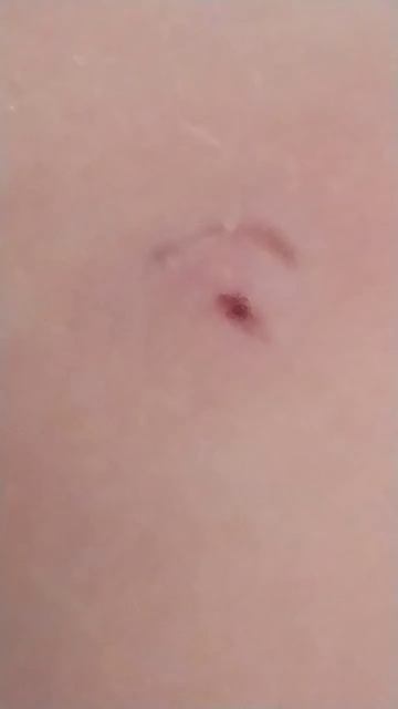 помните это видео снимала на подоконнике вот я и упала смотреть онлайн