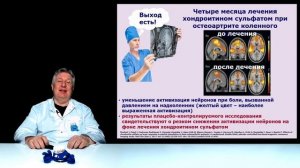 Хондрогард Квадро. Для суставов и нервной системы.