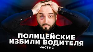 Избит. Запуган. Обвинён. Что будет дальше? ЧАСТЬ 2 | Малмыж