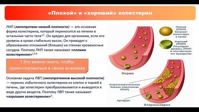 Холестерин . Плохой и хороший . Холестерин и статины