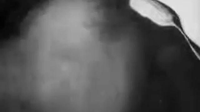 La Folie du Docteur Tube / Безумие доктора Тюба смотреть онлайн