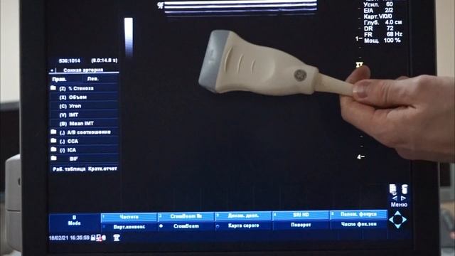 GE Logiq P6 обзор ультразвукового сканера смотреть онлайн