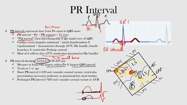 17.PR Interval