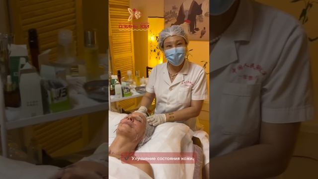 Летний секрет восточных красавиц: акупунктурный лифтинг без запретов на солнце