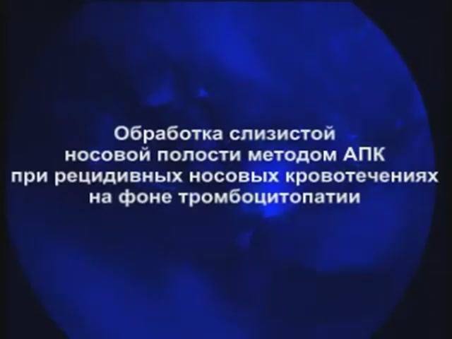 Обработка слизистой носовой полости методом АПК смотреть онлайн