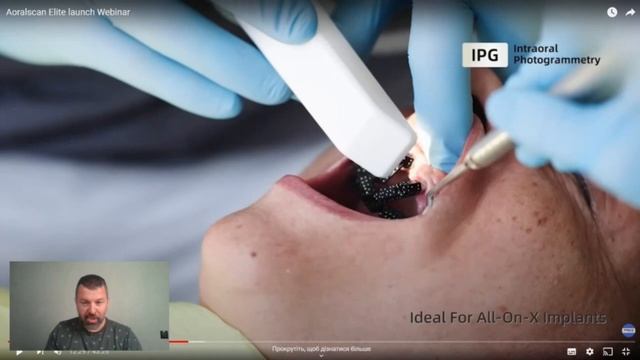 Огляд презентації новинки для стоматологів 3D сканера смотреть онлайн