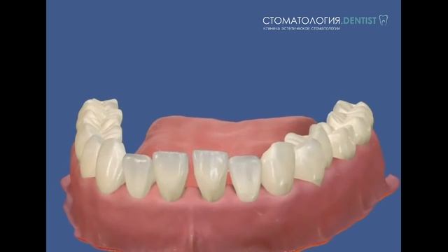 пародонтит клиническая картина в динамике смотреть онлайн