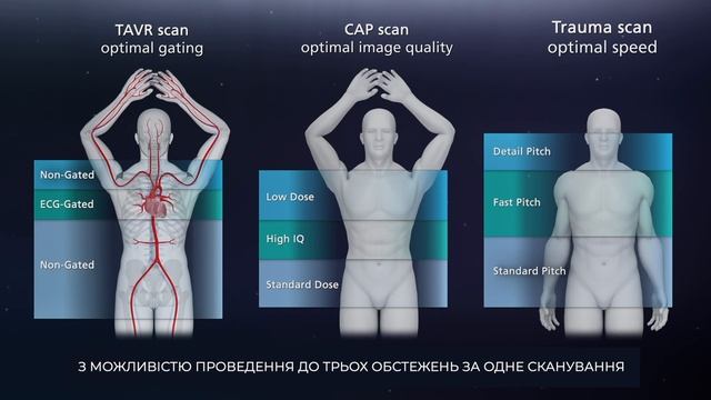 Aquilion Prime SP - передова модель комп'ютерного томографа ві смотреть онлайн