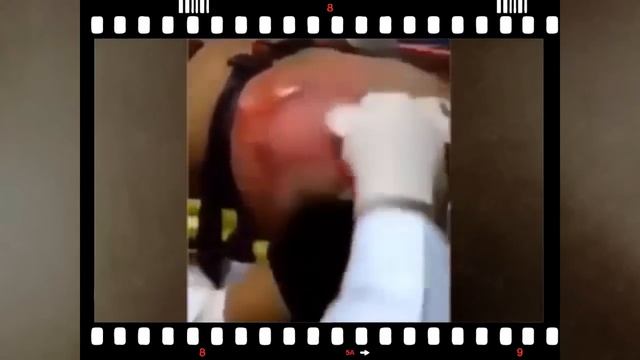 Вот к чему доводит энергетические напитки!