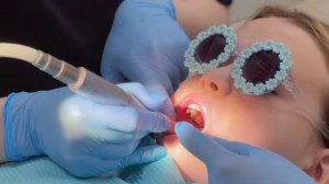 Лечение зубов у детей в клинике «Элайнер РФ»