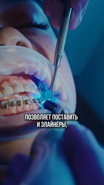 Что лучше в стоматологии?