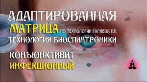 Конъюнктивит 🎶 программа матрица по технологии Гаряева П.П ☀️ SoftRadio.ru