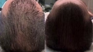 Холодная плазма