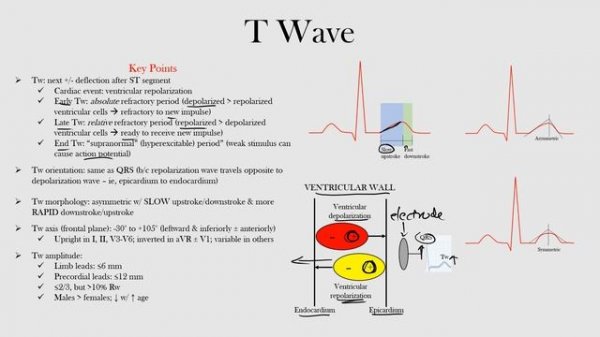 22.T Wave