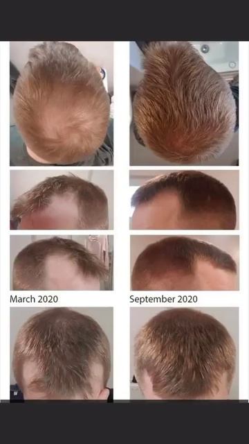 способы восстановления волос