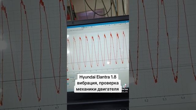 Hyundai Elantra 1.8 проверка механической части мотортестером смотреть онлайн