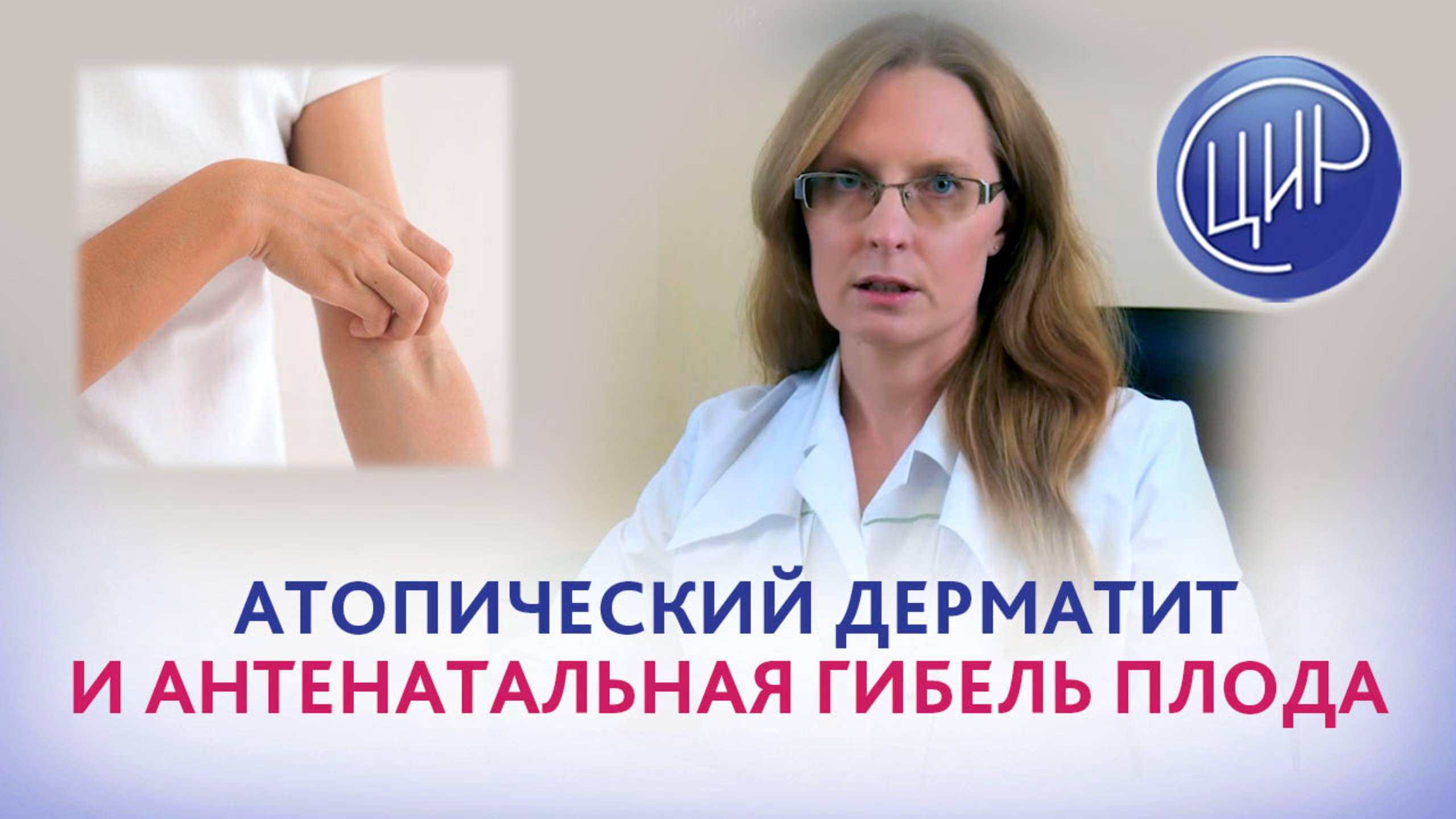Атопический дерматит и антенатальная гибель плода. Акушер-гинеколог ЦИР Дрожжина Анна Игоревна.