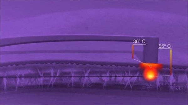 FaceTite - радиочастотный лифтинг