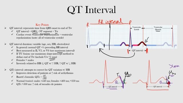 23.QT Interval смотреть онлайн