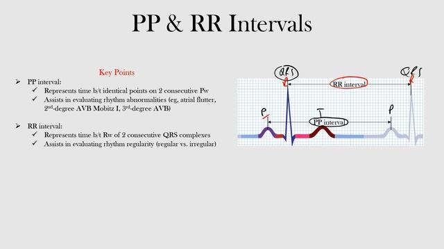 26.PP & RR Intervals смотреть онлайн