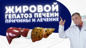 ЖИРОВОЙ ГЕПАТОЗ ПЕЧЕНИ: ПРИЧИНЫ И ЛЕЧЕНИЕ