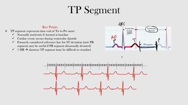 25.TP Segment
