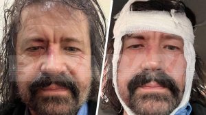 Игумен Евмений раскрыл подробности нападения в Москве