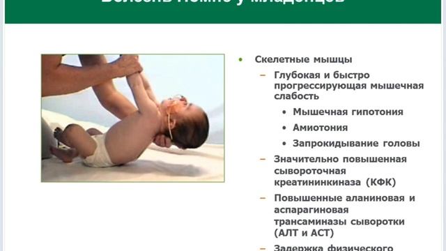 Наследственные заболевания нервной системы смотреть онлайн