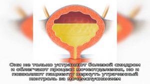 Самые эффективные лекарства от частого мочеиспускания