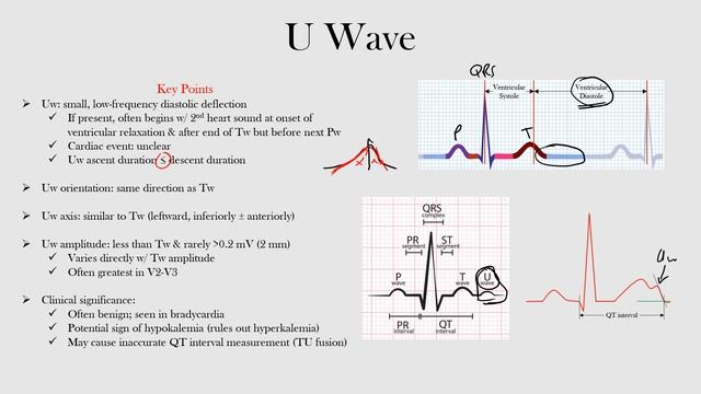 24.U Wave смотреть онлайн