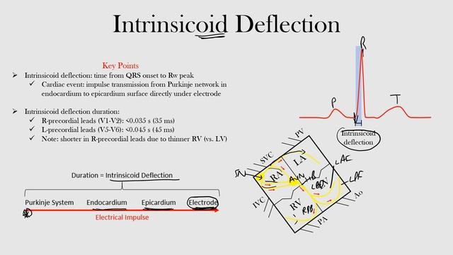 20.Intrinsicoid Deflection смотреть онлайн