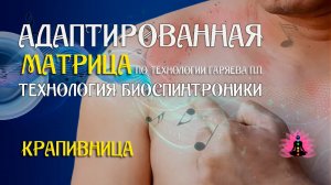 Крапивница 🎶 программа матрица по технологии Гаряева П.П ☀️ SoftRadio.ru