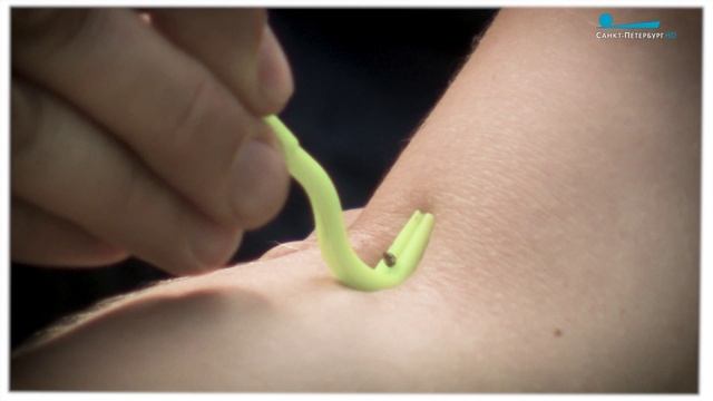 Первая помощь при укусе клеща смотреть онлайн