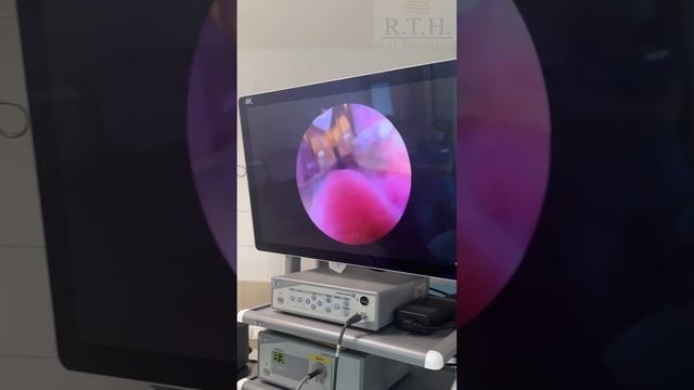 Лечение аденомы простаты на аппарате REZUM. Весь процесс. смотреть онлайн