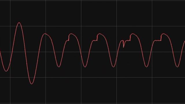 Stomach Noises №11 | Урчание в животе №11