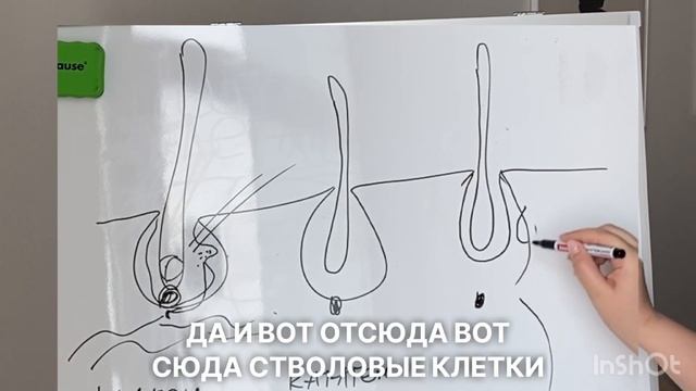 Как работает лазерная эпиляция | Мастерам эпиляции. смотреть онлайн