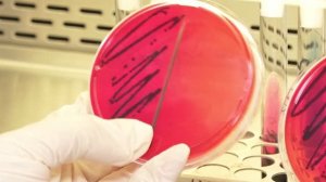 Питательные среды — основа для микробиологических исследований